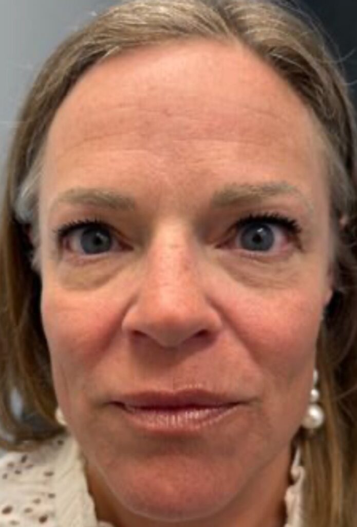 B-A Ultra Clear Tayler (1)