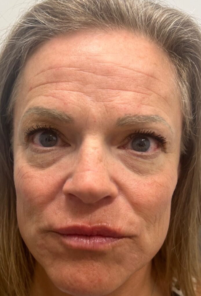 B-A Ultra Clear Tayler