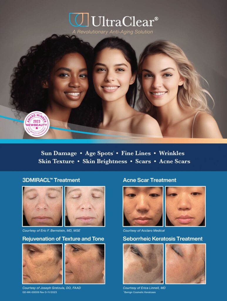 UltraClear_Counter_Card Tayler Laser Treatments in Salt Lake City, UT